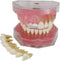 Smile1000 Dental Implant Teeth Model with Removable Teeth for Dental Professionals and Students