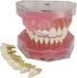 Smile1000 Dental Implant Teeth Model with Removable Teeth for Dental Professionals and Students