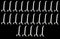 JSP Manufacturing 4" Plastic Pegboard Hooks for Garage, Tools, Storage, Jewelry, Craft - Multi-Colors (25 Pack)