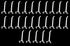 JSP Manufacturing 4" Plastic Pegboard Hooks for Garage, Tools, Storage, Jewelry, Craft - Multi-Colors (25 Pack)