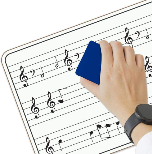 Scribbledo 5 Pack Dry Erase Music Staff White Boards, 9"X12" Double Sided Musical Notes Whiteboard for Kids Students