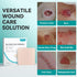Dimora Silicone Foam Dressing Without Border 4"x 4", Highly Absorbent Adhesive Wound Bandage, 5 Pack