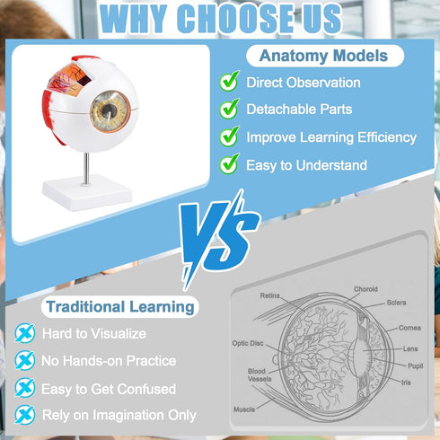 6X Eye Anatomy Model, Enlarged Eyeball Model, Human Eye Anatomical Model for Science Education Students Study Display
