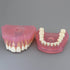 Smile1000 Dental Implant Teeth Model with Removable Teeth for Dental Professionals and Students