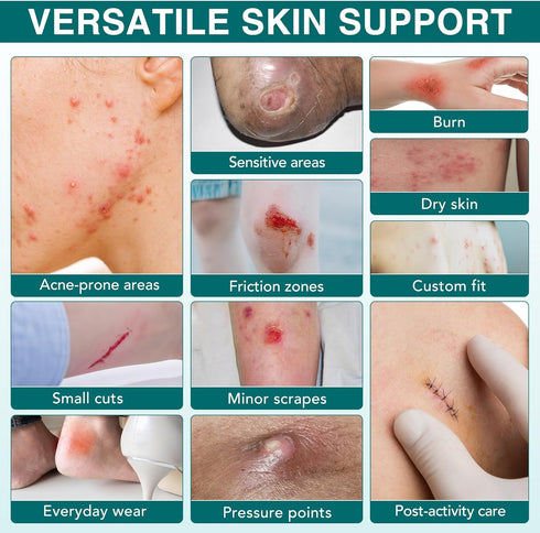Vortexonix Self-Adhesive-2in*11.8ft Hydrocolloid Bandages, Medical Grade Hydrocolloid Roll for Wound Care, Waterproof
