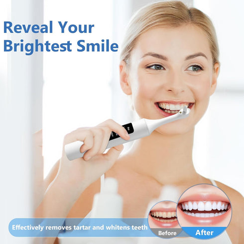 VixFonuy 6 5 Teeth Polisher Kit: Heads, Speed Modes - for Teeth Cleaning Tools, Suitable for Daily Home Use,USB