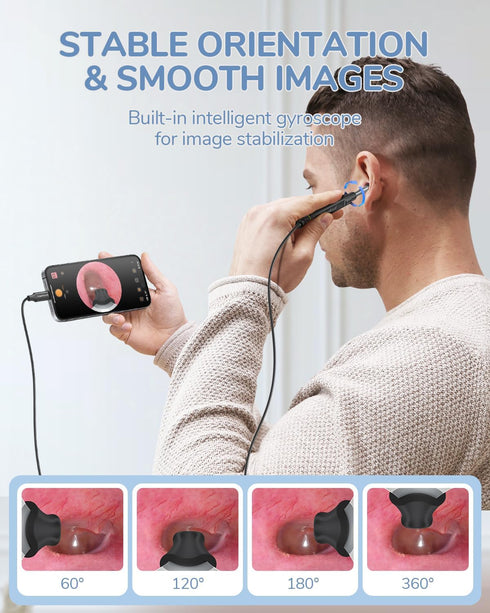 ScopeAround 1080P 3.9mm 6 Otoscope with Light, FHD Ear Scope, Digital Otoscope Camera with LED Lights Ear Wax Removal