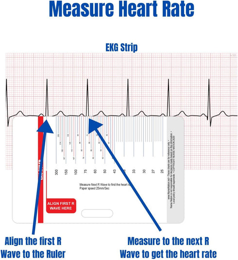 EKG Horizontal Badge 6 Card Set - ECG Telemetry Cards with EKG Ruler, Common Cardiac Findings, STEMI Leads