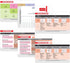 EKG Horizontal Badge 6 Card Set - ECG Telemetry Cards with EKG Ruler, Common Cardiac Findings, STEMI Leads