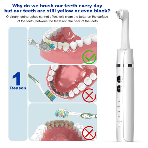 Light,6 Heads,5 Tooth Polisher,Teeth Polishing Kit for Daily Cleaning,Polishing Then Whitening of Tooth (Professional