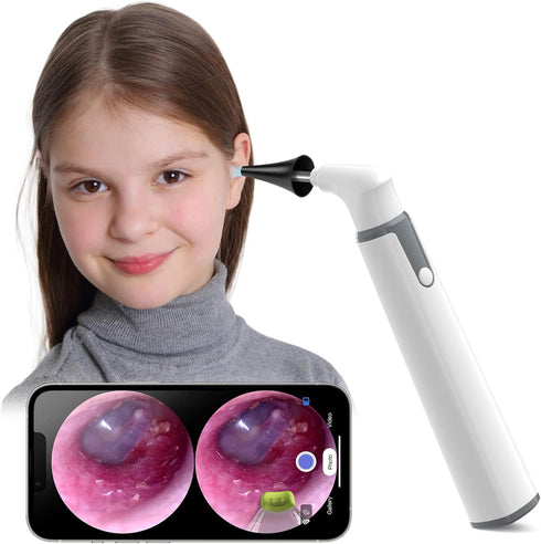 Wireless Otoscope Ear Camera with Dual View, 3.9mm 720PHD WiFi Ear Scope for Kids and Adults, Compatible with Android