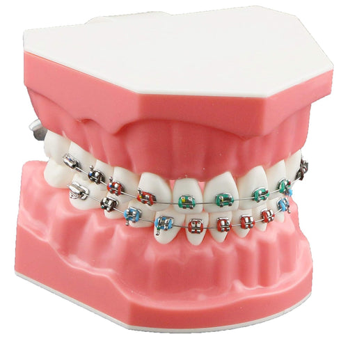 Typodonts Orthodontics Demonstration Model - Metal Wires and Bracket Teaching Model for Adults and Children