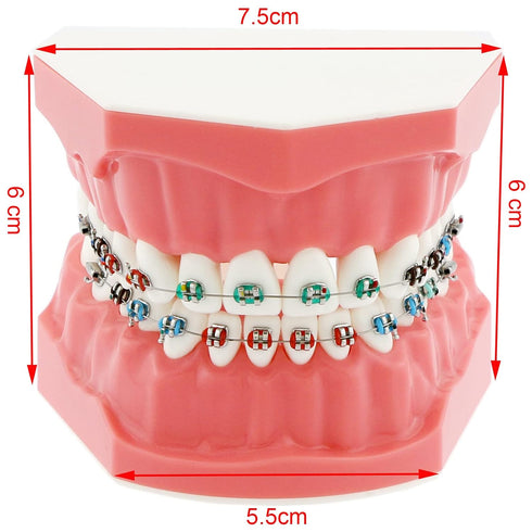 Typodonts Orthodontics Demonstration Model - Metal Wires and Bracket Teaching Model for Adults and Children