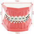 Typodonts Orthodontics Demonstration Model - Metal Wires and Bracket Teaching Model for Adults and Children