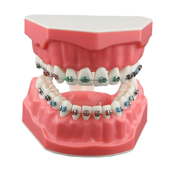 Typodonts Orthodontics Demonstration Model - Metal Wires and Bracket Teaching Model for Adults and Children