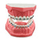 Typodonts Orthodontics Demonstration Model - Metal Wires and Bracket Teaching Model for Adults and Children