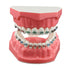 Typodonts Orthodontics Demonstration Model - Metal Wires and Bracket Teaching Model for Adults and Children