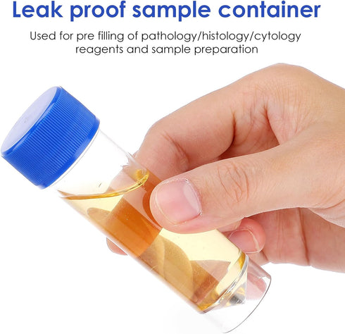 10pcs Plastic Specimen Cup with Lid Stool Specimen Container for Laboratory Medical Use (25-30ml, Without Spoon)
