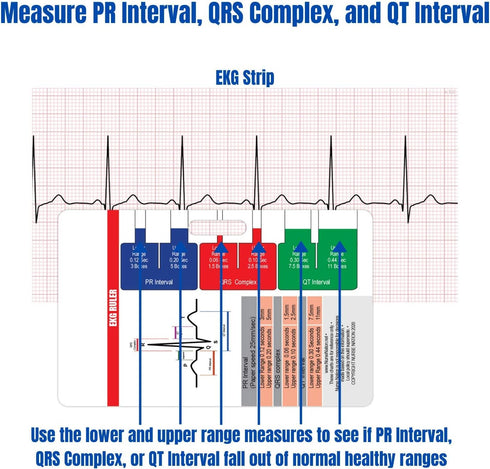 EKG Horizontal Badge 6 Card Set - ECG Telemetry Cards with EKG Ruler, Common Cardiac Findings, STEMI Leads