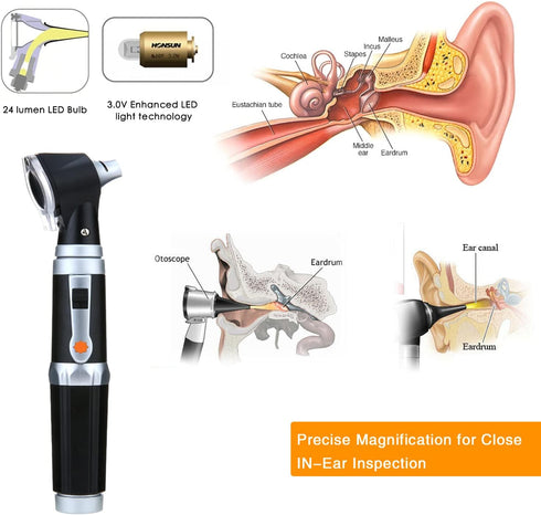 Jeebel Camp 3.0V Bulb, 3X 4 Otoscope Kit,Professional Diagnostic Ear Care Tool with LED Magnification, Speculum Tips
