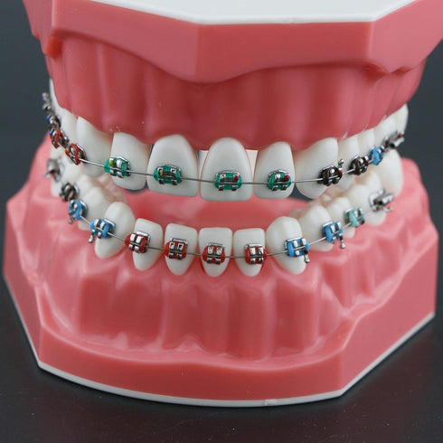 Typodonts Orthodontics Demonstration Model - Metal Wires and Bracket Teaching Model for Adults and Children