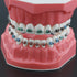 Typodonts Orthodontics Demonstration Model - Metal Wires and Bracket Teaching Model for Adults and Children