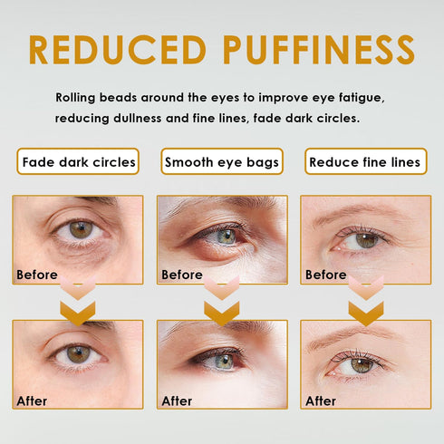 Time Eraser Oil, Roller Ball Castor Oil for Eyes, Frankincense Rollerball, Bags Under Eyes (2 boxes)