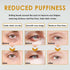 Time Eraser Oil, Roller Ball Castor Oil for Eyes, Frankincense Rollerball, Bags Under Eyes (2 boxes)