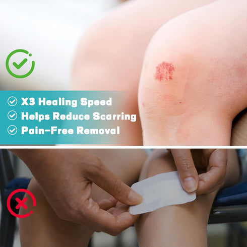 Ruzmmo (2in*5ft) Hydrocolloid Roll for Wound Care - Medical Grade Hydrocolloid Bandages with Flexible & Waterproof