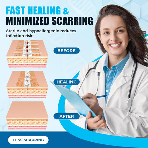 4 Wound Closure Device Pcs - Zip Sutures & Butterfly Bandage | Stitchless Wound Repair, Rapid Hemostasis for Hiking