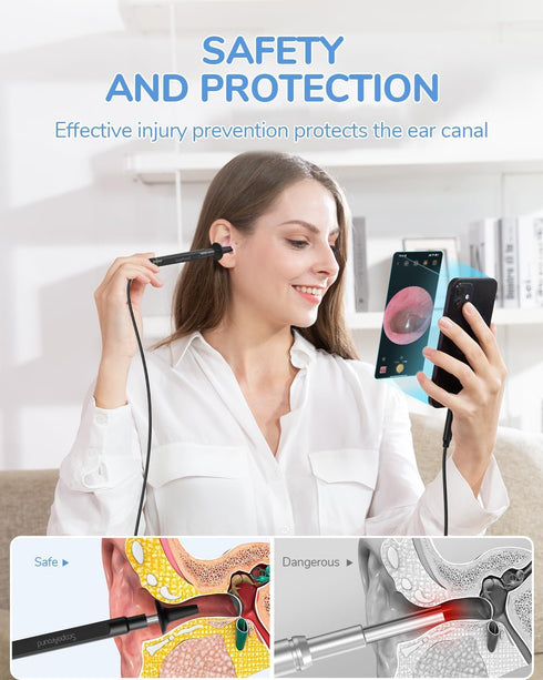 ScopeAround 1080P 3.9mm 6 Otoscope with Light, FHD Ear Scope, Digital Otoscope Camera with LED Lights Ear Wax Removal