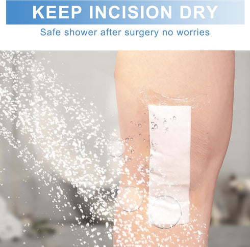 luanerl 30 Pack 4"x10" Waterproof Adhesive Island Dressing for Post-Surgery Recovery | Sterile Bordered Gauze Bandages