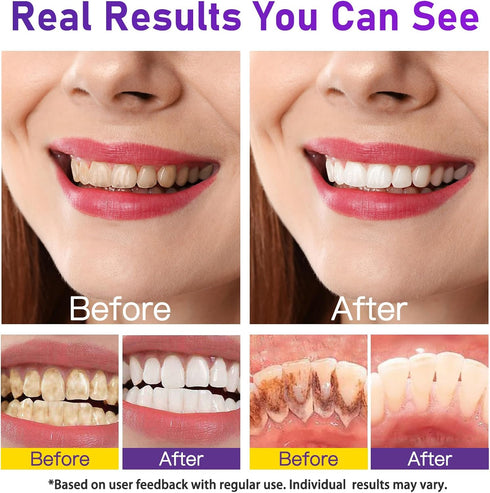BHMSHY 15g Enamel-Safe Teeth Whitening Powder Gentle on Teeth No Sensitivity Formula Removes Stains Breath Freshening