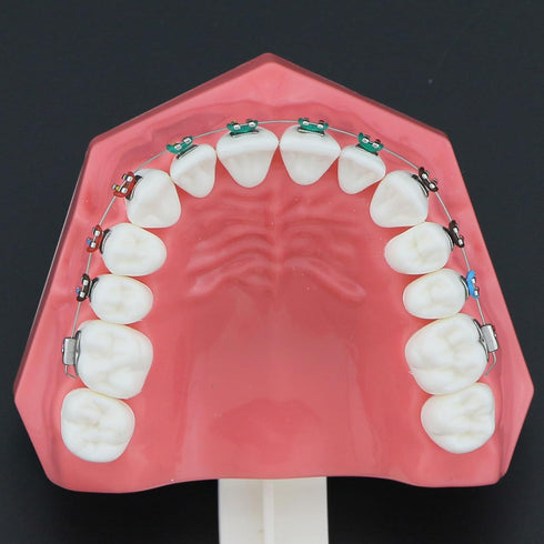 Typodonts Orthodontics Demonstration Model - Metal Wires and Bracket Teaching Model for Adults and Children