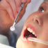 LED Light-Up Stainless Steel Tooth Mirror - Oral Care Tool