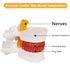 Model:1.5 breesky Human Anatomical Lumbar Disc Herniation Times Life Size Lumbar Disc Teaching Model Tool-for Medical