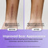 1.6" 60" AWD Medical Enhanced Silicone Scar Tape Roll, x Reusable Medical-Grade, Cut-to-Fit for C-Section, Surgery
