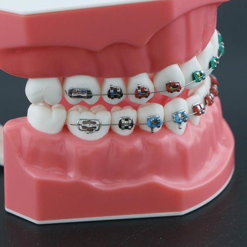 Typodonts Orthodontics Demonstration Model - Metal Wires and Bracket Teaching Model for Adults and Children