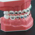 Typodonts Orthodontics Demonstration Model - Metal Wires and Bracket Teaching Model for Adults and Children