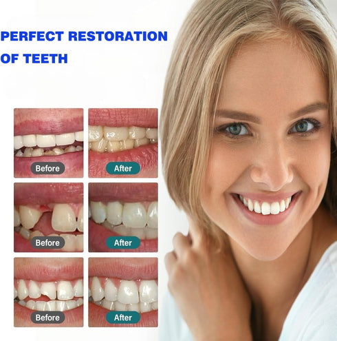 Silkylaser 2PCS Tooth Repair Kit Zinc Oxide Eugenol Cement Dental Care Kit, Temporary Teeth Replacement, Dental Care