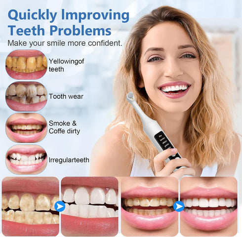 VixFonuy 6 5 Teeth Polisher Kit: Heads, Speed Modes - for Teeth Cleaning Tools, Suitable for Daily Home Use,USB