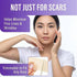 1.6" 60" AWD Medical Enhanced Silicone Scar Tape Roll, x Reusable Medical-Grade, Cut-to-Fit for C-Section, Surgery