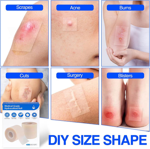 LukToMao 2" 19.7' Hydrocolloid Roll Hydrocolloid Bandages for Wound Care, Waterproof SelfAdhesive Hydrocolloid Tape
