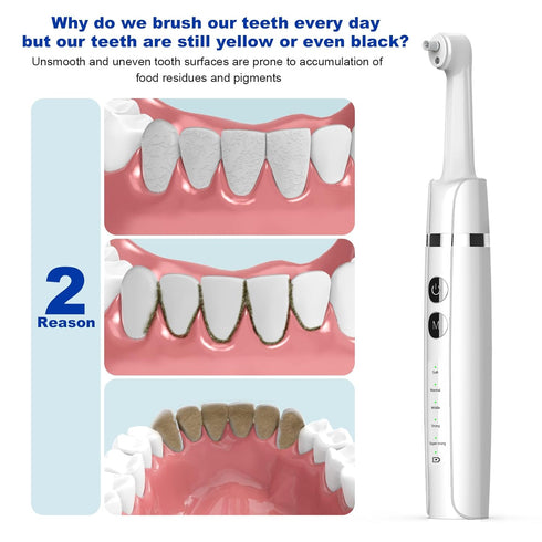 Light,6 Heads,5 Tooth Polisher,Teeth Polishing Kit for Daily Cleaning,Polishing Then Whitening of Tooth (Professional