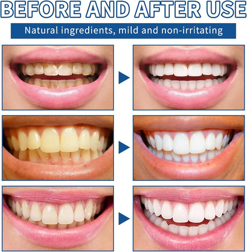 Generic 2PCS (1) Teeth Whitening Powder, Whitening Powder Fresh Breath, No Sensitivity Stain Removal, Enhanced