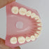 Smile1000 Dental Implant Teeth Model with Removable Teeth for Dental Professionals and Students