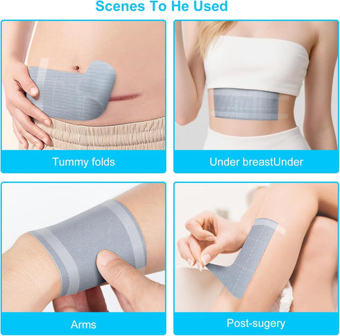 HearthMend 10x144 Inch Silver Infused Fabric Roll, Breathable & Non-Adherent Wound Dressing Wrap for Skin Fold