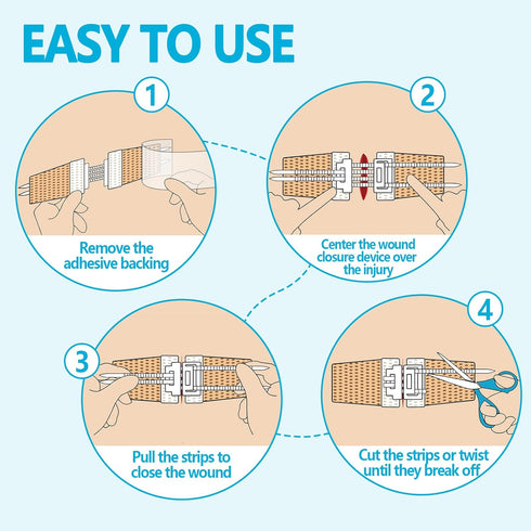 4 Wound Closure Device Pcs - Zip Sutures & Butterfly Bandage | Stitchless Wound Repair, Rapid Hemostasis for Hiking