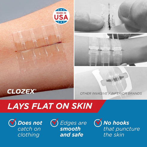 Clozex 2 2 Inches Emergency Laceration Closures - Repair Wounds Without Stitches, FSA HSA Eligible Skin Closure Device