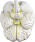 VAB401-3 Models-3 Vision Scientific Life Size Human Brain Parts | Shows Frontal, Parietal, Temporal & Occipital Lobes |